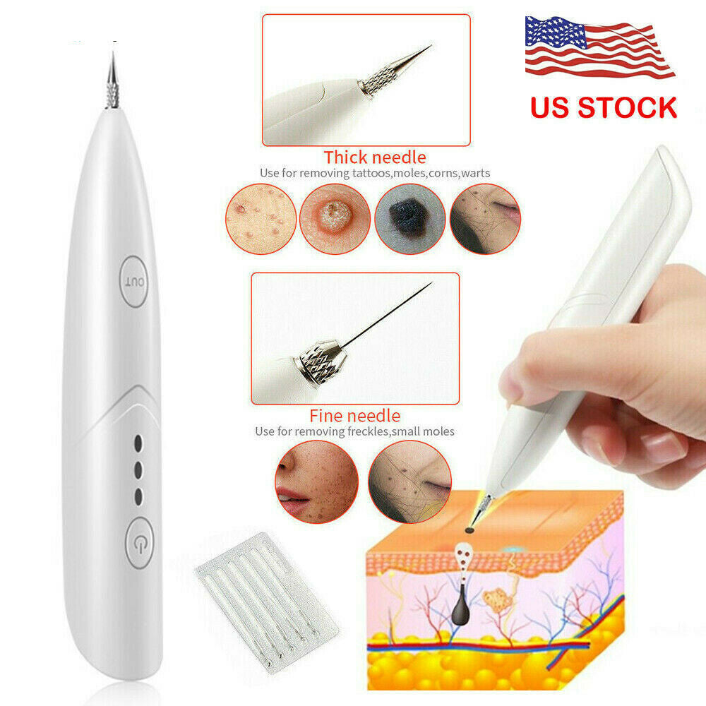 Ion Laser Freckle Skin Mole Dark Spot Remover Face Wart Tag Tattoo Removal Pen Ion Laser Freckle Skin Mole Dark Spot Remover Face Wart Tag Tattoo Removal Pen